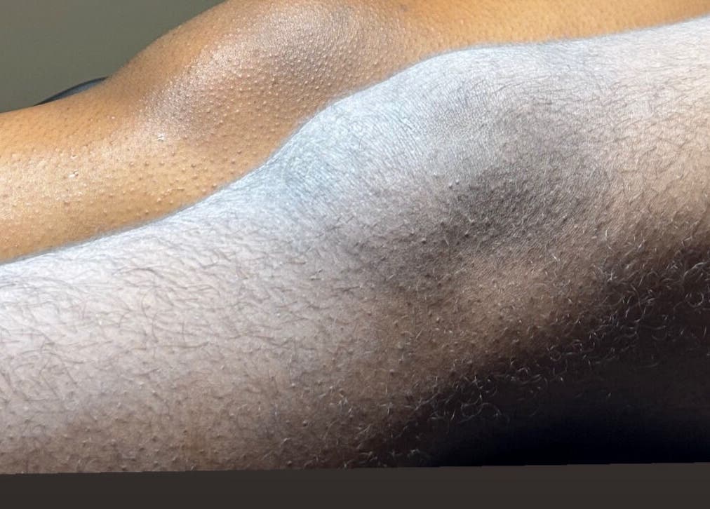 Smooth skin after sugaring at The Sugaring Salon in Willemstad, CW. Experience silky skin today.