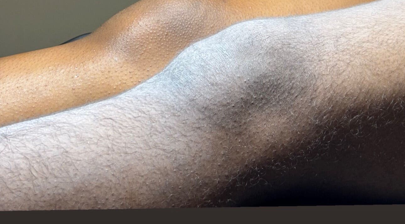 Smooth skin after sugaring at The Sugaring Salon in Willemstad, CW. Experience silky skin today.