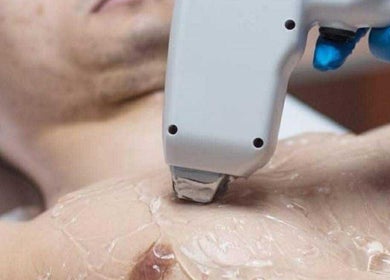 Laser hair removal at GENT BEAUTY PMU & Laser Hair Removal, Gent, Vlaanderen, BE.