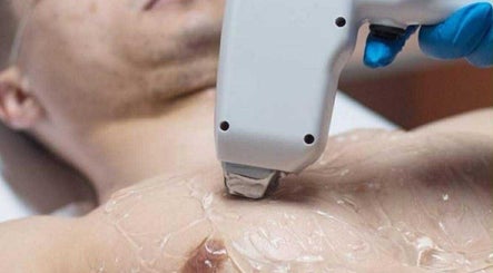 Laser hair removal at GENT BEAUTY PMU & Laser Hair Removal, Gent, Vlaanderen, BE.