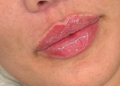 Glossy lips treatment at Aesthetics and Beauty by Nadine, Rayleigh, England, GB enhances natural beauty.