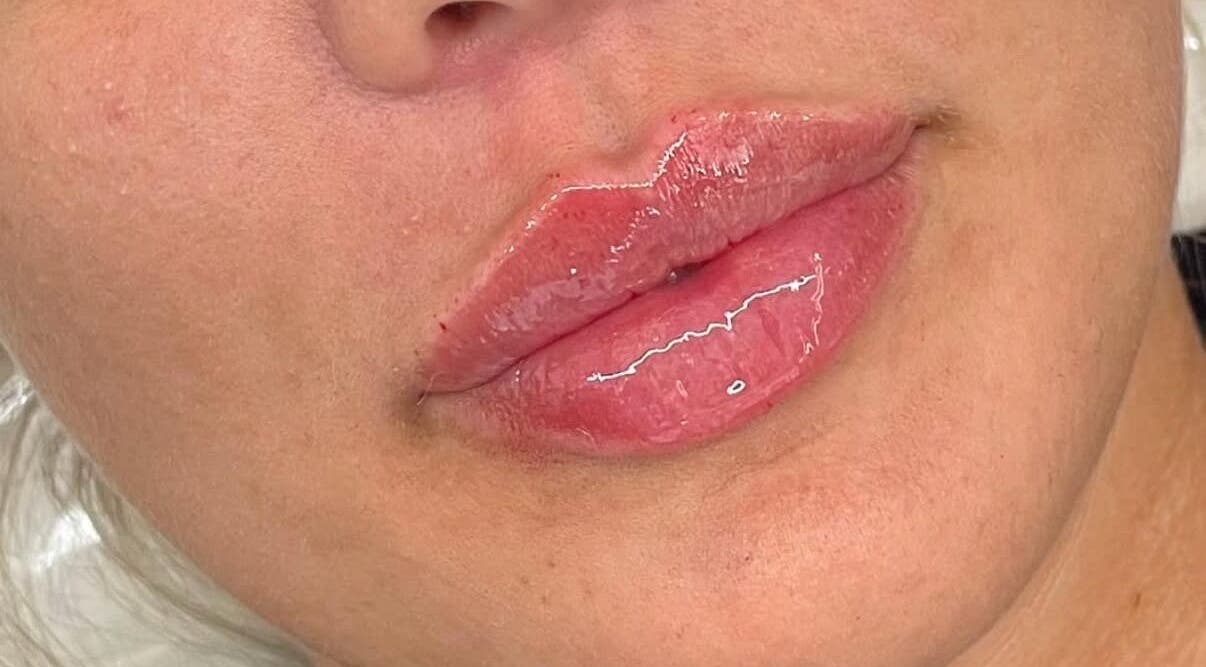 Glossy lips treatment at Aesthetics and Beauty by Nadine, Rayleigh, England, GB enhances natural beauty.