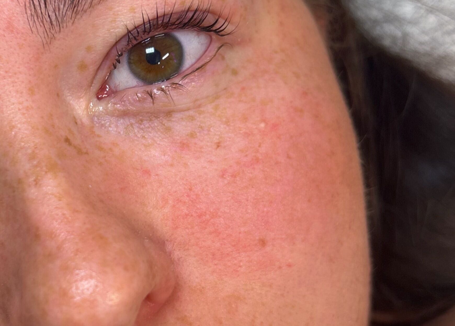 Close-up of a fresh, radiant skin tone at Defined by Alex in Darlington, England, GB.