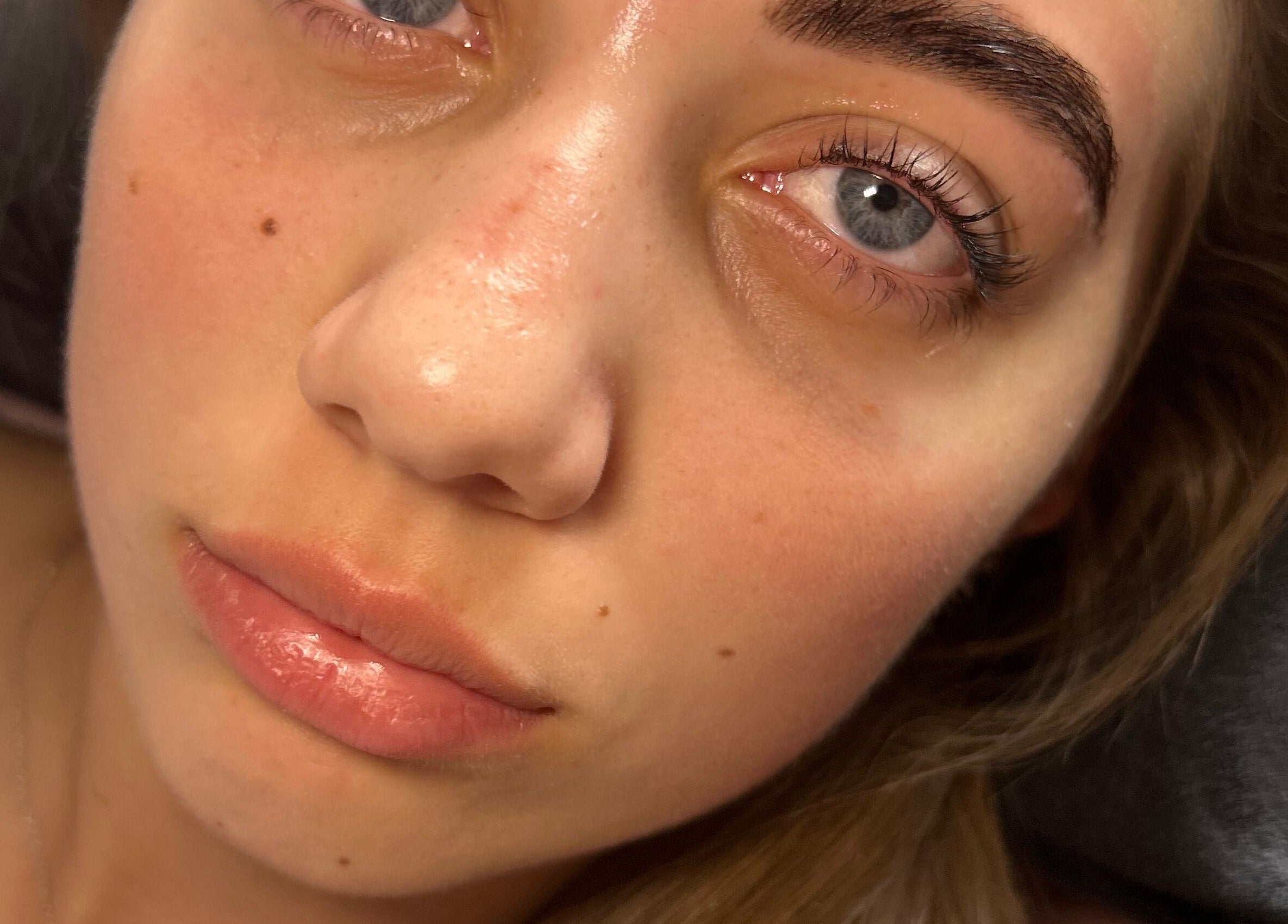 Close-up of a woman's radiant skin treated at Defined by Alex, Darlington, England, GB.