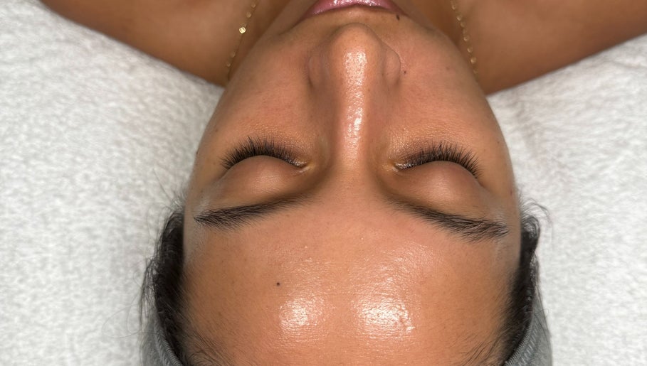 Smooth, glowing skin post-treatment at Revive Skin Studio in San Jose, California, US.
