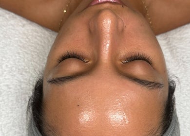 Smooth, glowing skin post-treatment at Revive Skin Studio in San Jose, California, US.