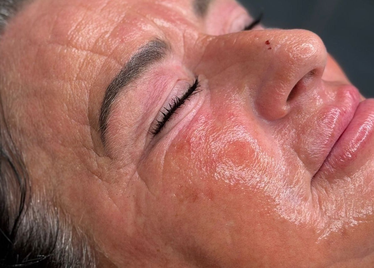 Close-up of a glowing, rejuvenated face after treatment at Macey Jaye Aesthetics, Leigh, England, GB.