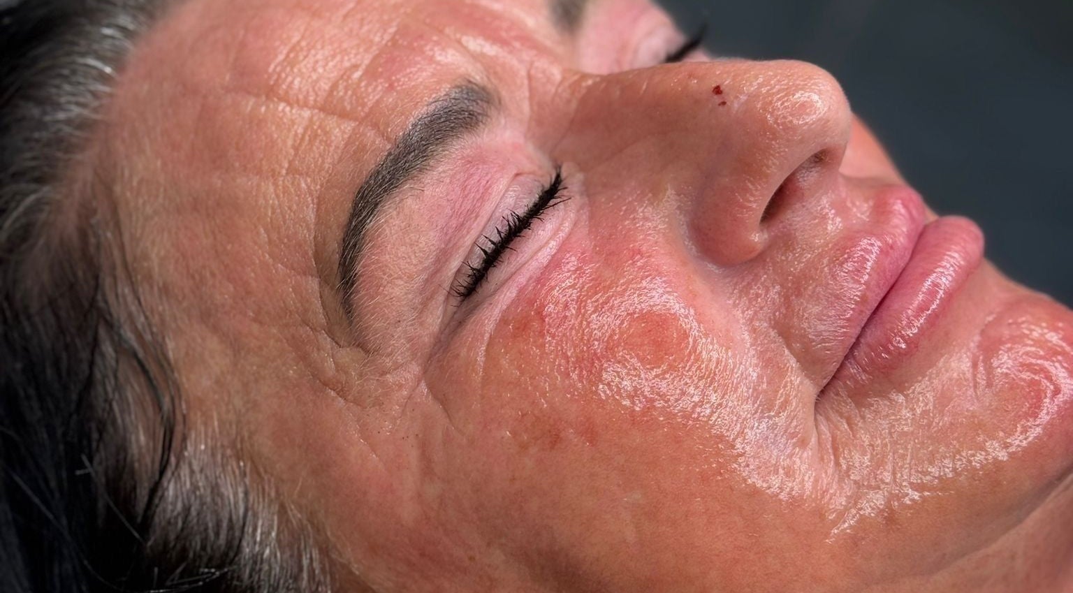 Close-up of a glowing, rejuvenated face after treatment at Macey Jaye Aesthetics, Leigh, England, GB.