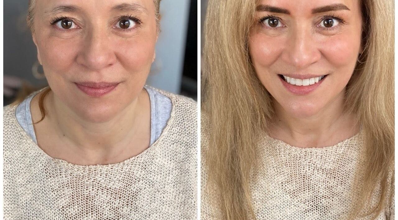 Before and after hair makeover at SkyBeauty Valencia, València, Comunidad Valenciana, ES.