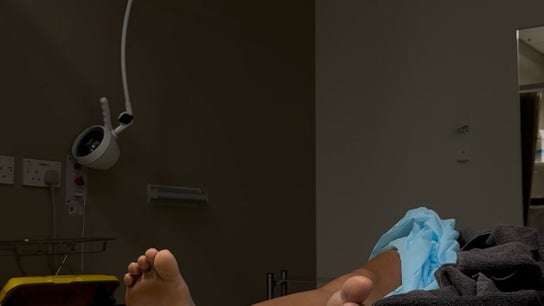 HaWB Treatment