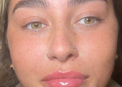 Close-up of a woman's face with glowing skin at Elite Aesthetics by Charlene, Merthyr Tydfil, Cymru, GB.