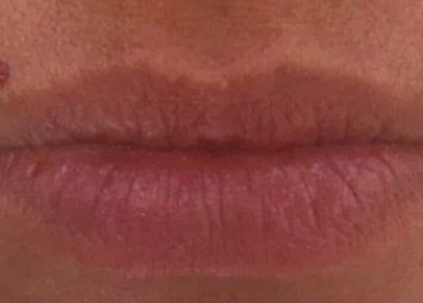 Close-up of natural lips at Elite Aesthetics by Charlene, Merthyr Tydfil, Cymru, GB.