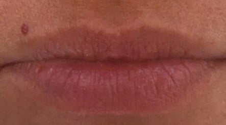 Close-up of natural lips at Elite Aesthetics by Charlene, Merthyr Tydfil, Cymru, GB.