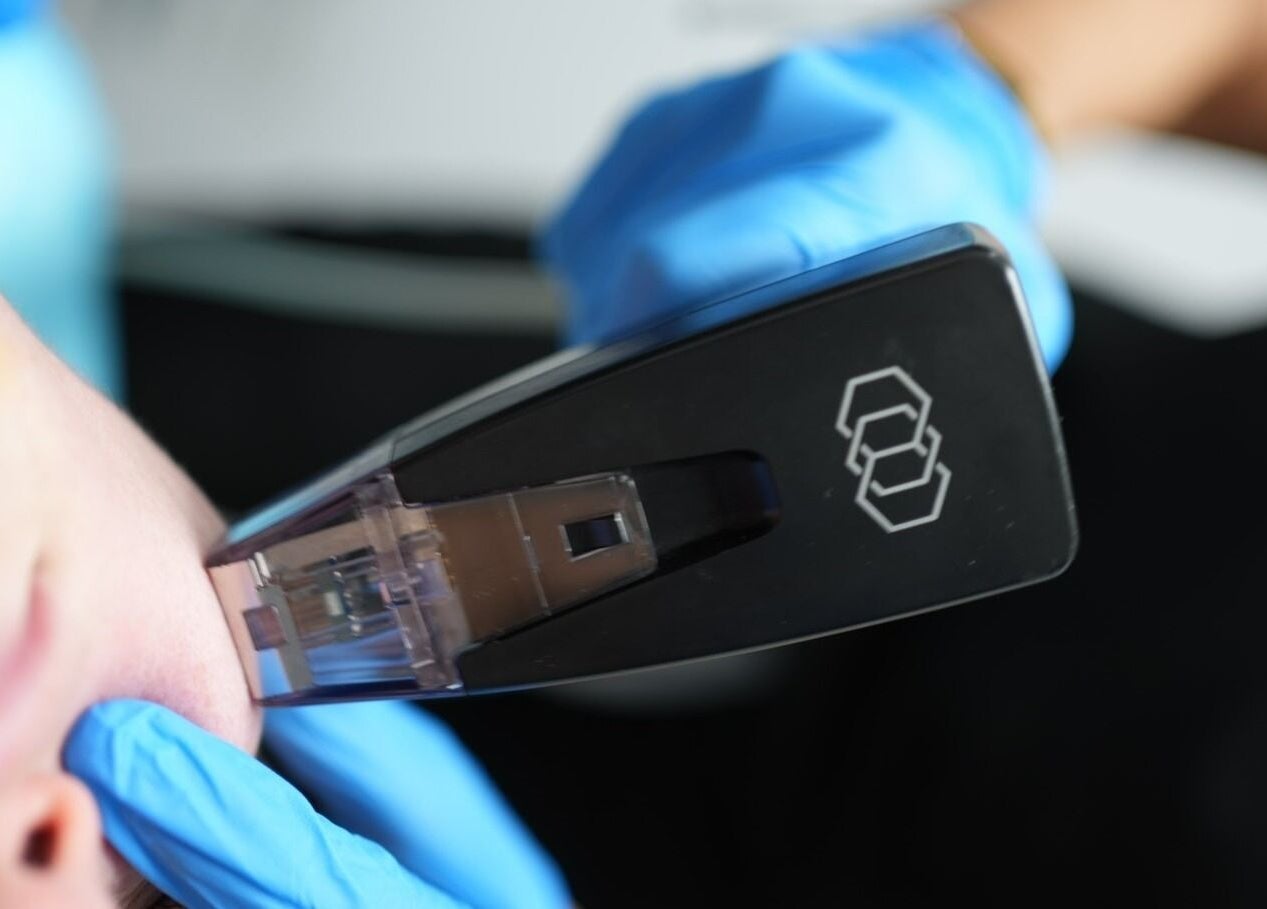 Close-up of SmoothSculpt treatment at Revival Med Spa Aesthetics, New York, New York, US.