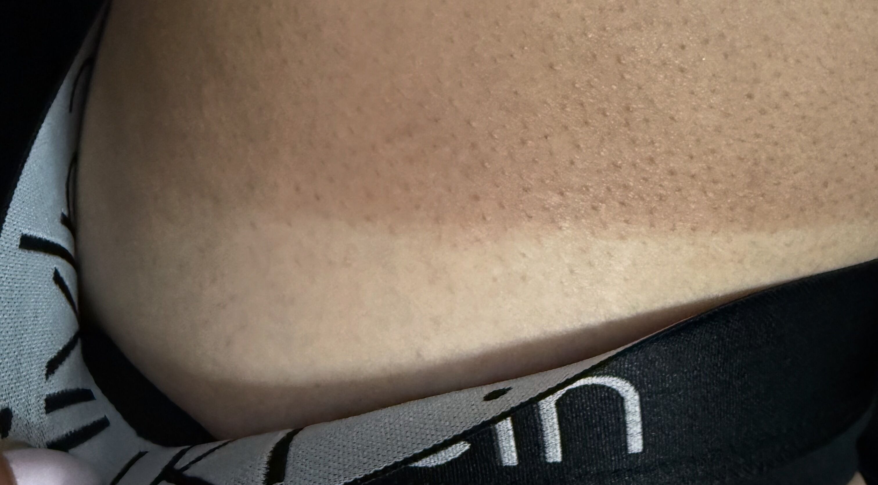 Close-up of skin texture and tan line, Glowhaus, Fairfield, New South Wales, AU.