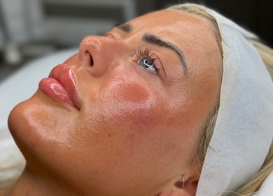Client receiving facial treatment at The Skin Theory, Lichfield, England, GB, showcasing glowing skin.