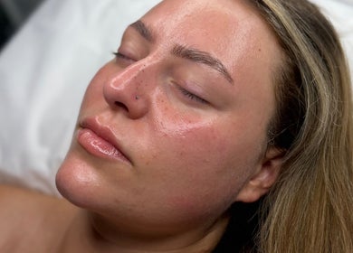 Close-up of a serene face post-treatment at The Skin Theory, Lichfield, England, GB highlighting impeccable skin.