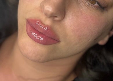 Close-up of glossy lips after treatment at WZAesthetics London, located in London, England, GB.