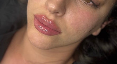 Close-up of glossy lips after treatment at WZAesthetics London, located in London, England, GB.