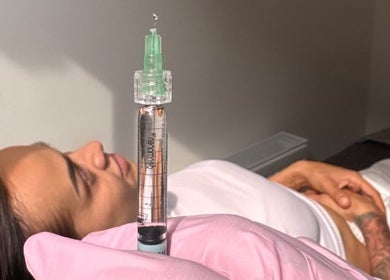Relaxed patient during dermal filler treatment at WZAesthetics London, located in London, England, GB.