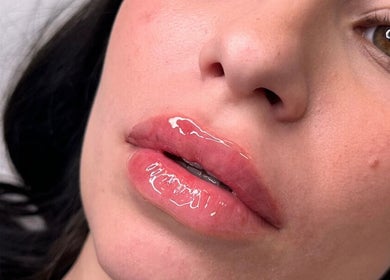 Close-up of glossy lips from WZAesthetics London, located in London, England, GB.