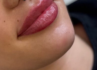 Close-up of glossy lips after treatment at WZAesthetics London, London, England, GB.