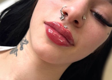 Close-up of lip enhancement at WZAesthetics London, England, GB showcasing glossy lips and lashes.
