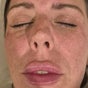 Revive Aesthetics Herts