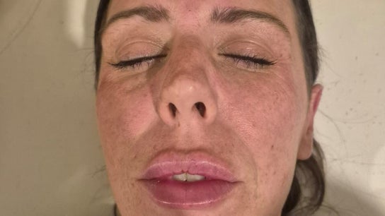 Revive Aesthetics Herts