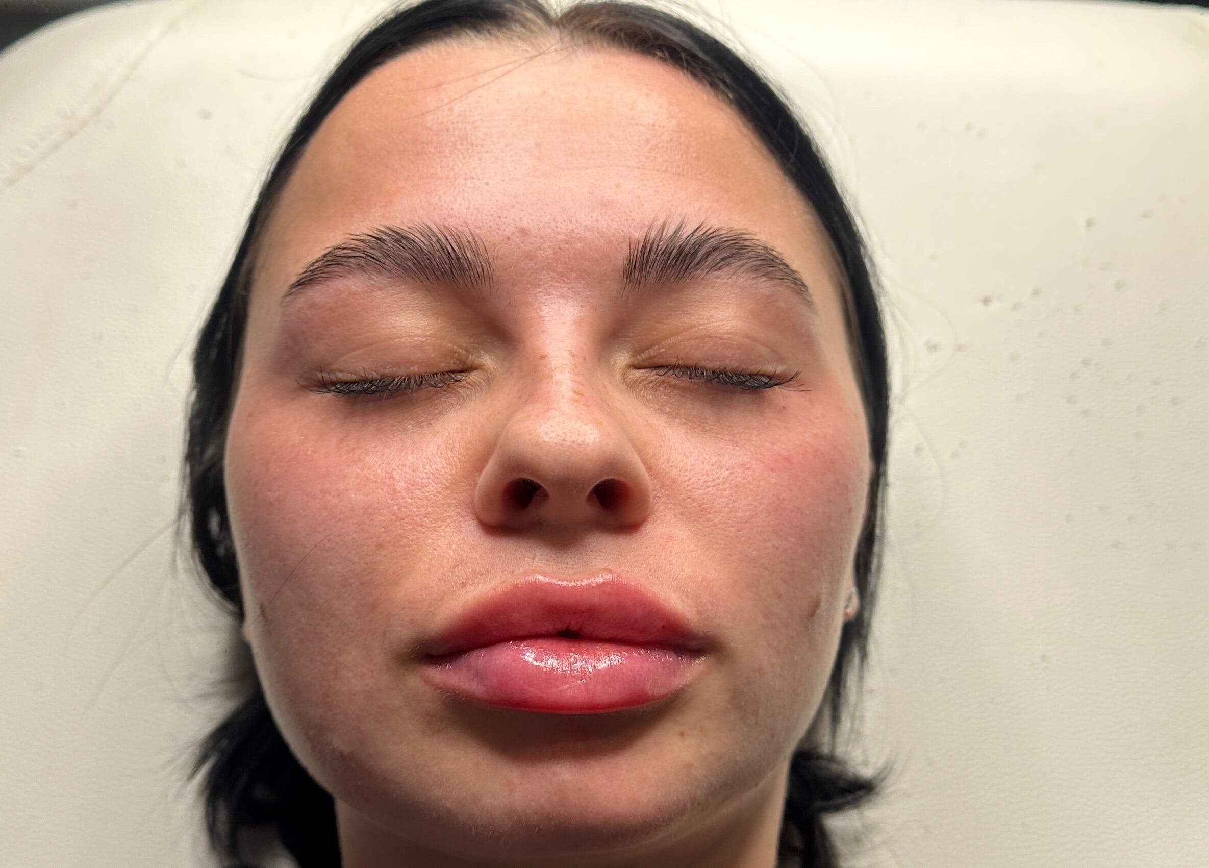 Relaxed woman enjoying a facial at Revive Aesthetics Herts in Watford, England, GB.