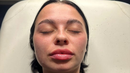 Revive Aesthetics Herts