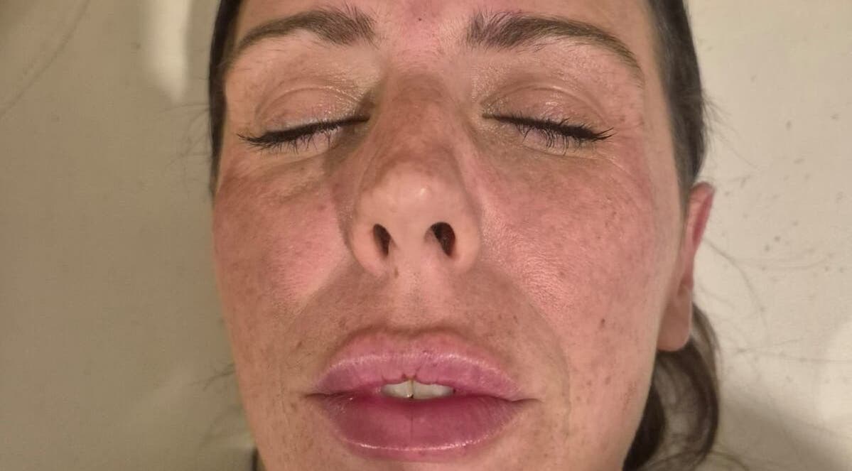 Close-up of a serene face with enhanced skin radiance at Revive Aesthetics Herts, Watford, England, GB.