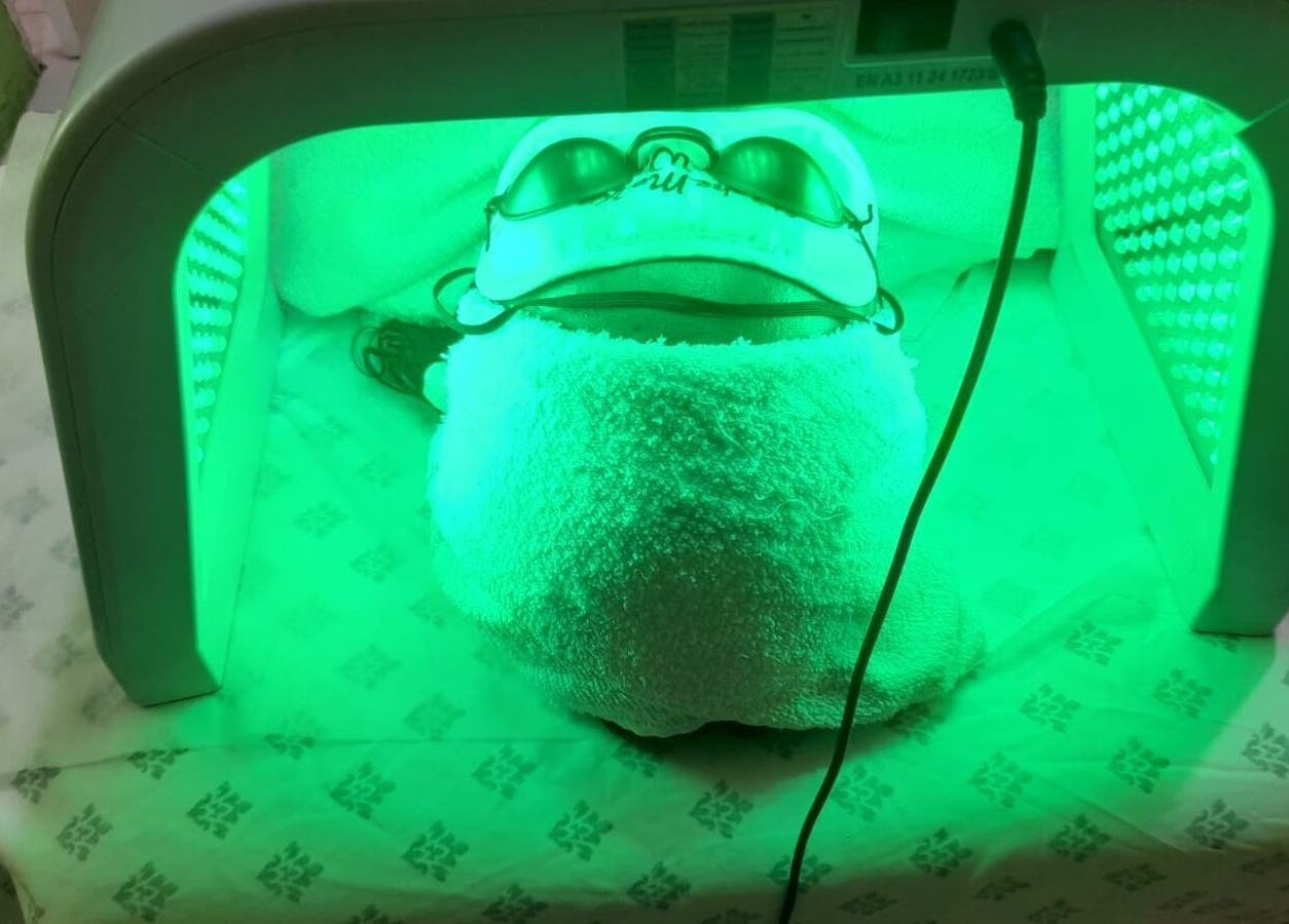 LED facial treatment at Suzanne's Body Care, 68 Hagley Park Road, Kingston, St. Andrew Parish, JM.