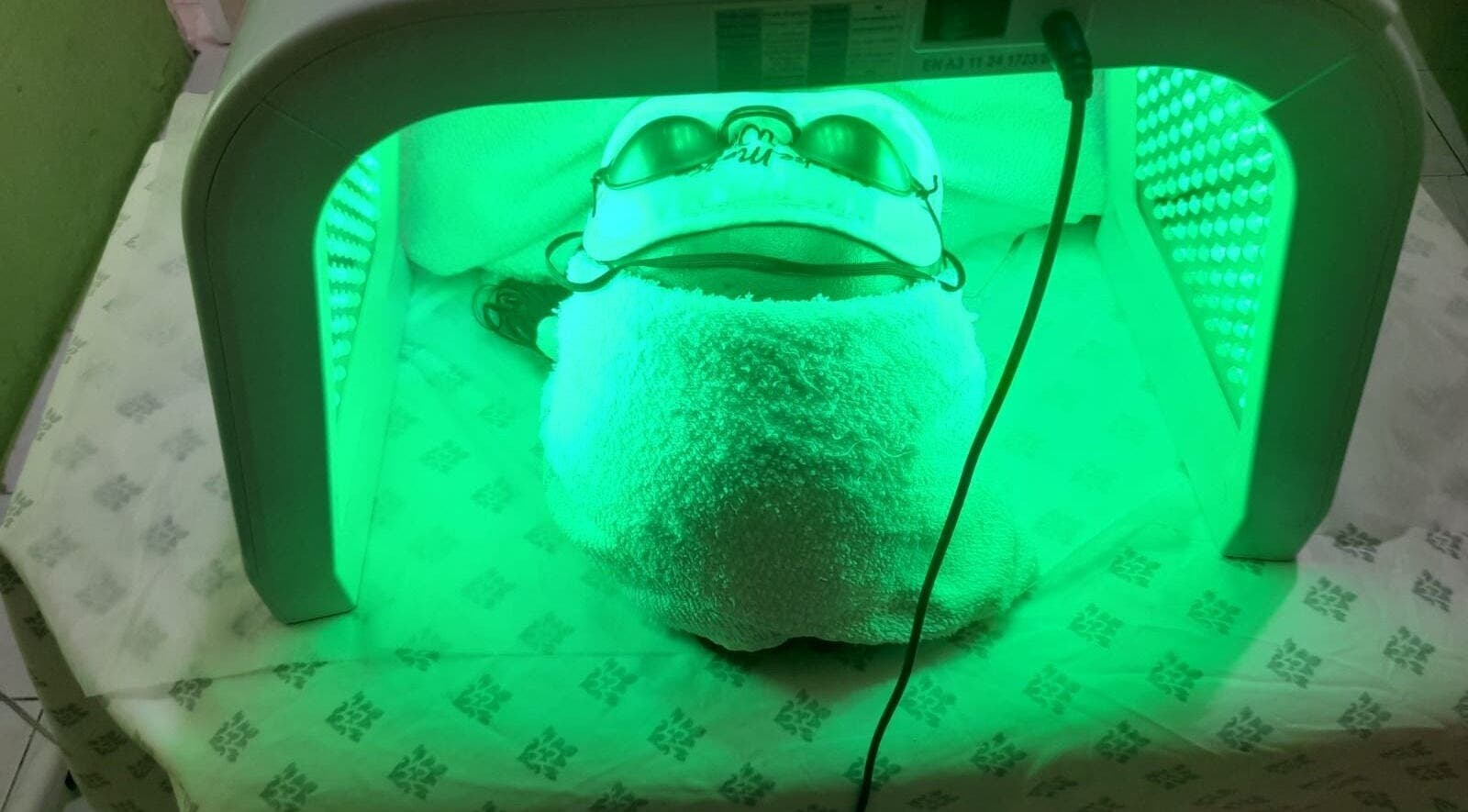 LED facial treatment at Suzanne's Body Care, 68 Hagley Park Road, Kingston, St. Andrew Parish, JM.