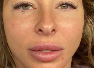 Close-up of a serene face showcasing glowing skin at Byjords, Salford, England, GB.