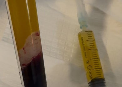 PRP treatment tools at The Healing Place Global LTD, Taverham, England, GB.