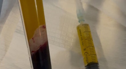 PRP treatment tools at The Healing Place Global LTD, Taverham, England, GB.