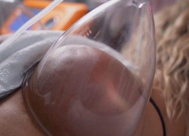 Vacuum therapy at Cátia Lima Beauty, Montijo, Setúbal, PT, enhancing skin tone and elasticity.