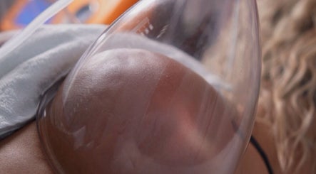 Vacuum therapy at Cátia Lima Beauty, Montijo, Setúbal, PT, enhancing skin tone and elasticity.