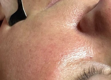 Close-up of a skincare procedure at Beautifully Layered Skin in Kernersville, North Carolina, US.