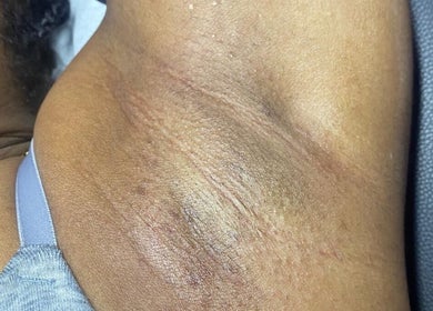 Close-up of an underarm showing skin texture at Ccallicosmetics, Speightstown, Saint Peter, BB.