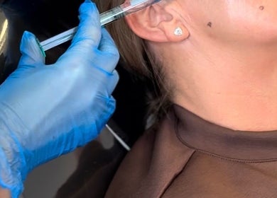 Professional skin treatment at Glow With Grace, Banbury, England, GB, featuring a precision injection.