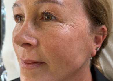 Close-up of a woman's face after beauty treatment at Glow With Grace, Banbury, England, GB.