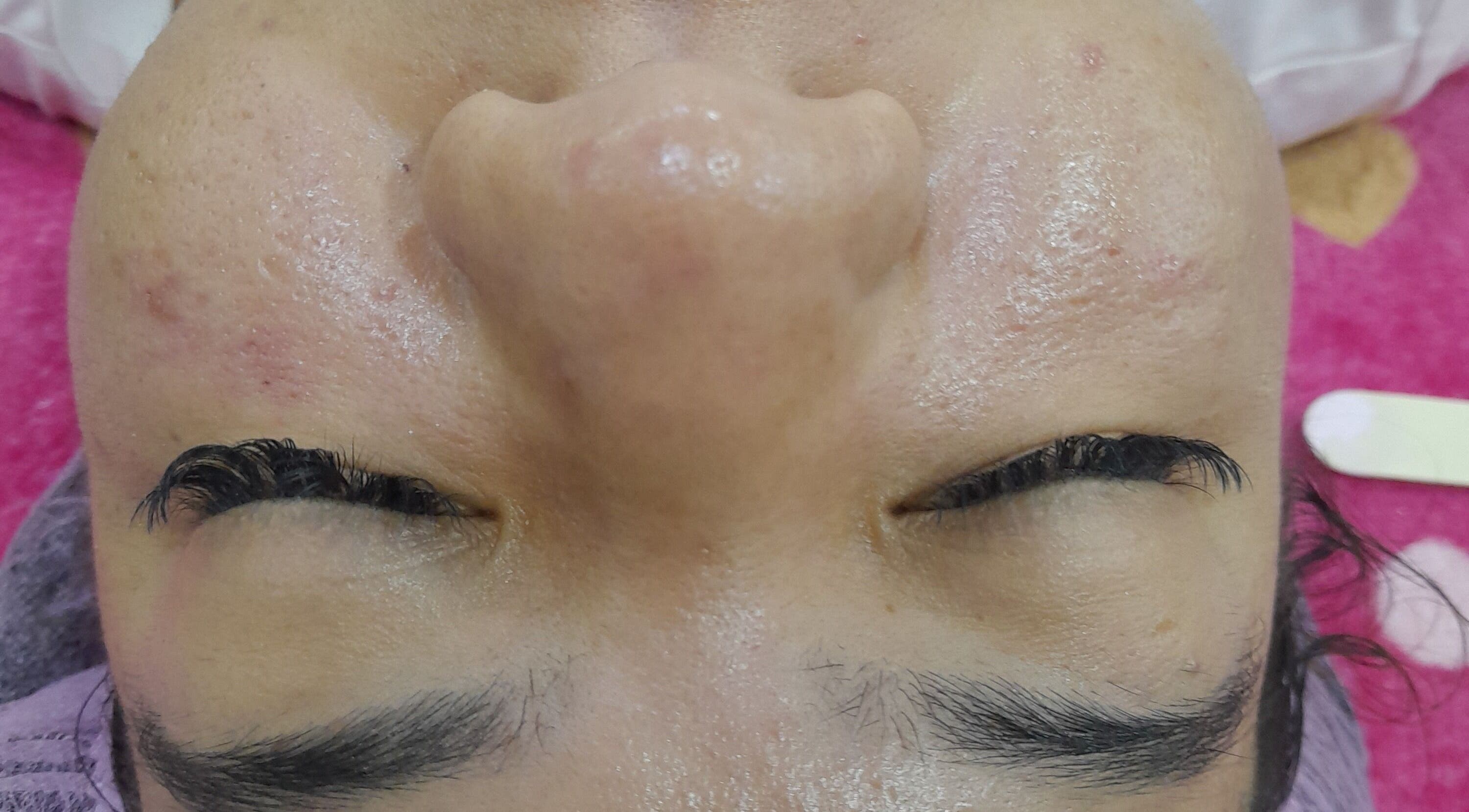 Close-up of a client's smooth, glowing complexion at Genamil.ve, Maracay, Aragua, VE.