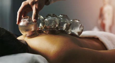 Séance de cupping chez Cupping Thérapy, Yutz, Grand Est, FR. Les ventouses sur le dos soulagent efficacement.