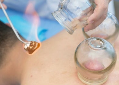 Thérapie par ventouses au Cupping Thérapy, Yutz, Grand Est, FR. Expérience de bien-être unique.