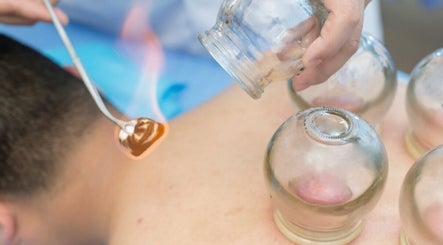 Thérapie par ventouses au Cupping Thérapy, Yutz, Grand Est, FR. Expérience de bien-être unique.