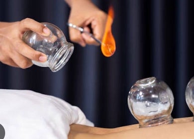 Therapie par ventouses en action à Cupping Thérapy, Yutz, Grand Est, FR illustrant des ventouses en verre.