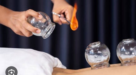 Therapie par ventouses en action à Cupping Thérapy, Yutz, Grand Est, FR illustrant des ventouses en verre.