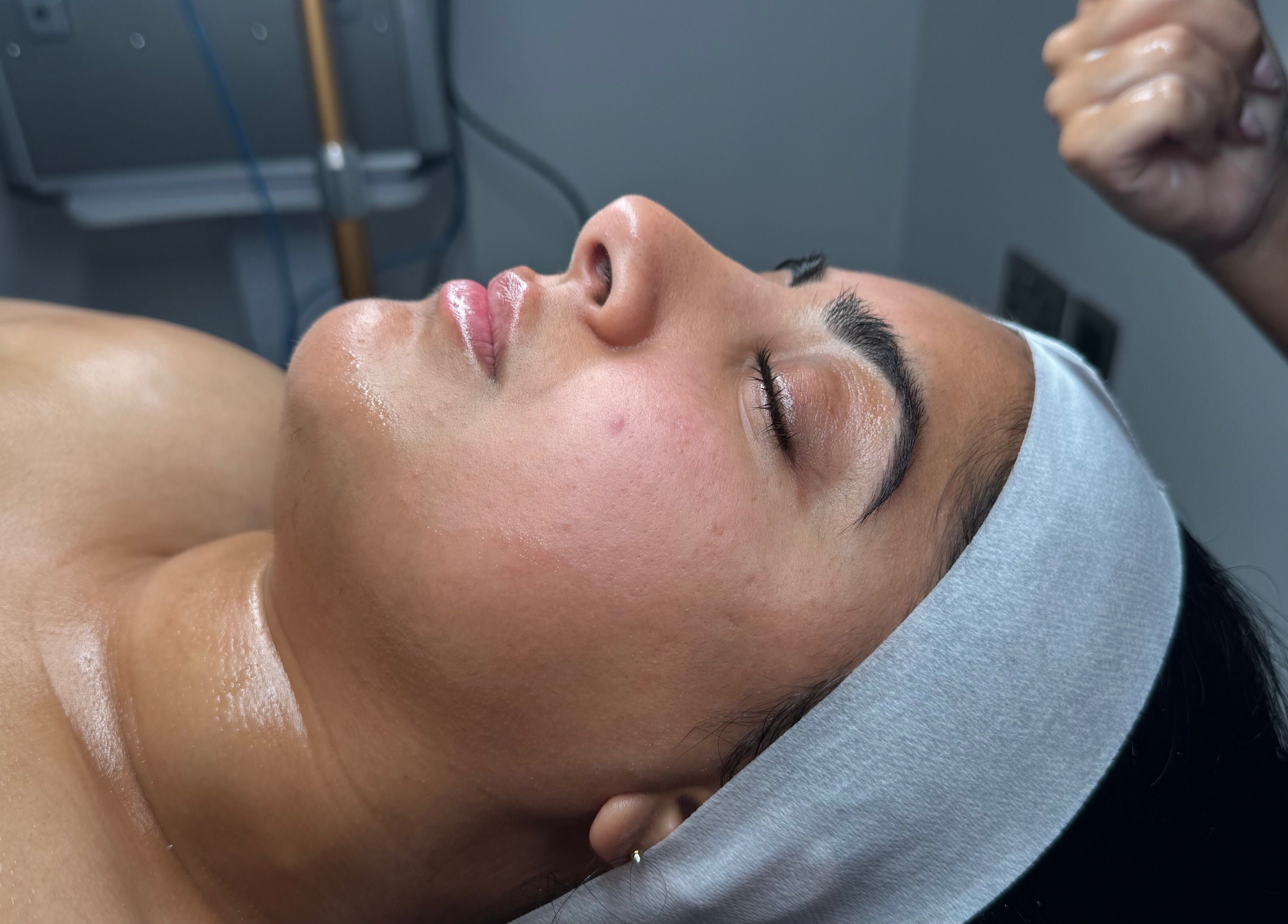 Facial treatment at Ak Clinic in Wolverhampton, England, GB, showcasing relaxation and skincare.